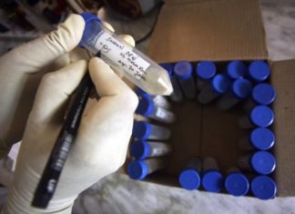 Hospital del estado de Washington alerta sobre brote interno de tuberculosis