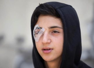 Las pérdidas oculares en la represión de jóvenes manifestantes conmueve en Chile