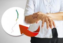 Extirpación de apéndice podría ser protección contra enfermedad de Parkinson