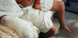 Representante de la ONU lamenta número de menores quemados por pólvora en Honduras