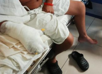 Quemados con pólvora en Honduras ascienden a casi un centenar previo a Navidad