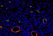 Descubren cómo las células tumorales pueden estar latentes durante años
