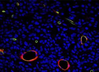 La ciencia abre una nueva vía contra los tumores cerebrales más agresivos