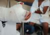 Nueve personas ingresan a hospitales de Honduras por quemaduras producto de la pólvora