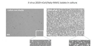 Científicos italianos aíslan el coronavirus para el desarrollo de tratamiento