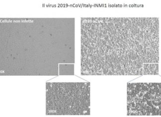 Científicos italianos aíslan el coronavirus para el desarrollo de tratamiento