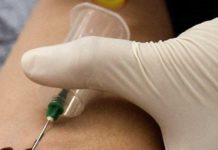 Los médicos confirman la segunda curación del mundo de un paciente con VIH