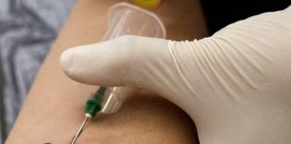 Los médicos confirman la segunda curación del mundo de un paciente con VIH