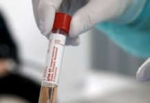 Confirman cuatro nuevos casos de hondureños con Covid-19 en España