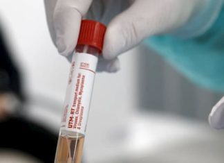 Confirman cuatro nuevos casos de hondureños con Covid-19 en España