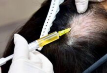 Ensayo muestra la capacidad de células madre para hacer crecer el cabello