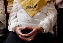 Describen la historia natural del Alzheimer en personas con síndrome de Down