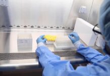 Honduras ya suma 343 muertos y 10.739 contagiados por la COVID-19