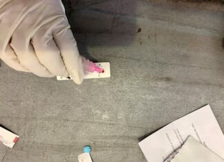 Los casos globales de COVID-19 llegan a casi 9,3 millones, según la OMS