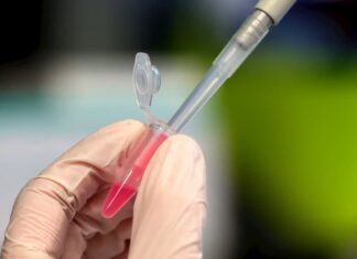 Sudáfrica, primer país africano en sumarse a ensayo de vacuna contra COVID-19