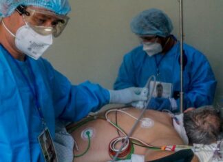Pacientes con hígado graso pueden desarrollar formas más graves de COVID-19