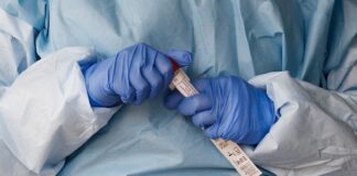 América supera a Europa en número de fallecidos, con más de 185.800