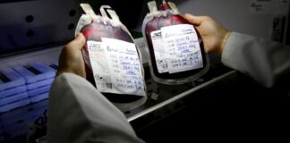 Sangre de tipo A se asocia a mayor riesgo de sufrir una covid-19 más severa