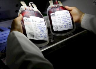 Sangre de tipo A se asocia a mayor riesgo de sufrir una covid-19 más severa