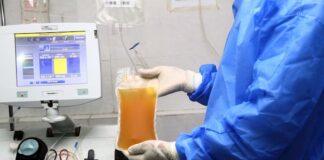 Guatemala implementa un tratamiento con plasma para enfermos de COVID-19 plasma covid