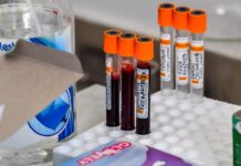 Una prueba de sangre podría predecir el desarrollo de alzhéimer