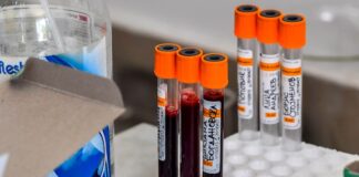 Alemania ofrecerá test en los aeropuertos como alternativa a la cuarentena