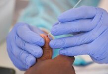 Los fallecidos en Honduras por COVID suben a 2.249 y a 73.193 los contagios covid