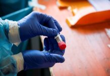 Coronavirus se dispara en Europa con España y Francia con 2.000 casos diarios