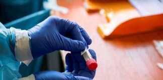 Coronavirus se dispara en Europa con España y Francia con 2.000 casos diarios