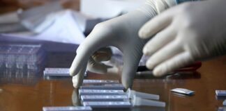 Los casos globales suman 21,2 millones y España regresa al top diez