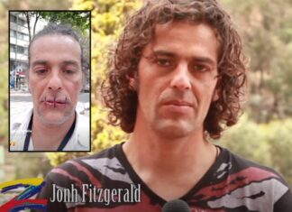 Escultor colombiano se cose los labios para reclamar más atención a artistas