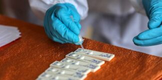 Desarrollan en Japón un test de anticuerpos de covid usando gusanos de seda Investigadores de la Universidad de Kyushu