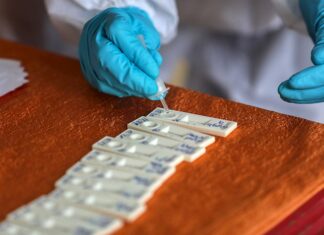 Muertes globales por COVID suben a 1,4 millones, con cifra récord en Europa Investigadores de la Universidad de Kyushu