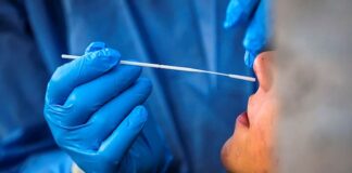 El SARS-CoV-2 podría entrar en el cerebro a través de la nariz SARS-CoV-2