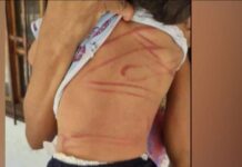 La brutal agresión sufrida por un niño de dos años causa conmoción en Bolivia