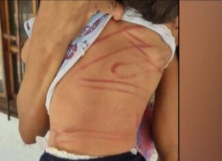 La brutal agresión sufrida por un niño de dos años causa conmoción en Bolivia