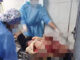 Un asaltante fallecido y tres personas heridas es el resultado de enfrentamiento entre policías y grupo delictivo