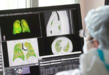 La covid-19 podría causar anomalías pulmonares meses después del contagio pulmones