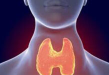 Los síntomas se presentan de forma leve al comienzo, conoce del hipotiroidismo