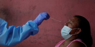 Las PCR no pueden causar daño cerebral ni tienen nada que ver con lobotomías