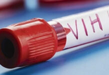 Califican de discriminación exigir prueba de vih en Honduras para un empleo