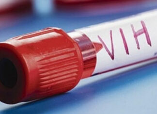 Califican de discriminación exigir prueba de vih en Honduras para un empleo