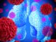 Inmunoterapia es una esperanza de vida para pacientes con cáncer de pulmón