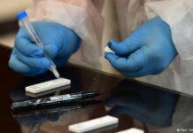 EEUU autoriza por primera vez un test de anticuerpos que se hace en casa