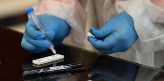 EEUU autoriza por primera vez un test de anticuerpos que se hace en casa