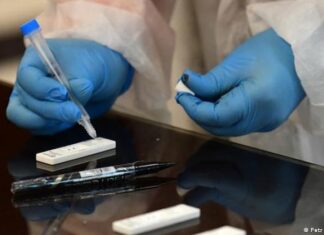 EEUU autoriza por primera vez un test de anticuerpos que se hace en casa