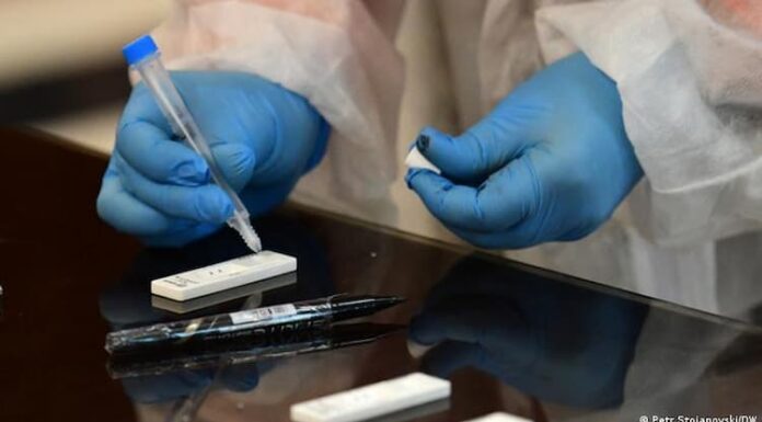 EEUU autoriza por primera vez un test de anticuerpos que se hace en casa