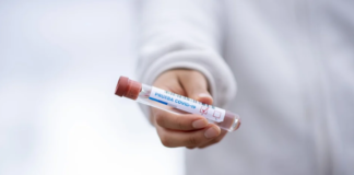 Gracias a Dios e Intibucá no registran casos de las tres variantes que circulan en Honduras