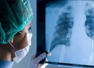 ¡Alarmante! Jóvenes contagiados de covid-19 reportan un 90% de afectación pulmonar