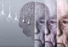 El nuevo fármaco contra alzheimer, «esperanzador» en diagnósticos tempranos
